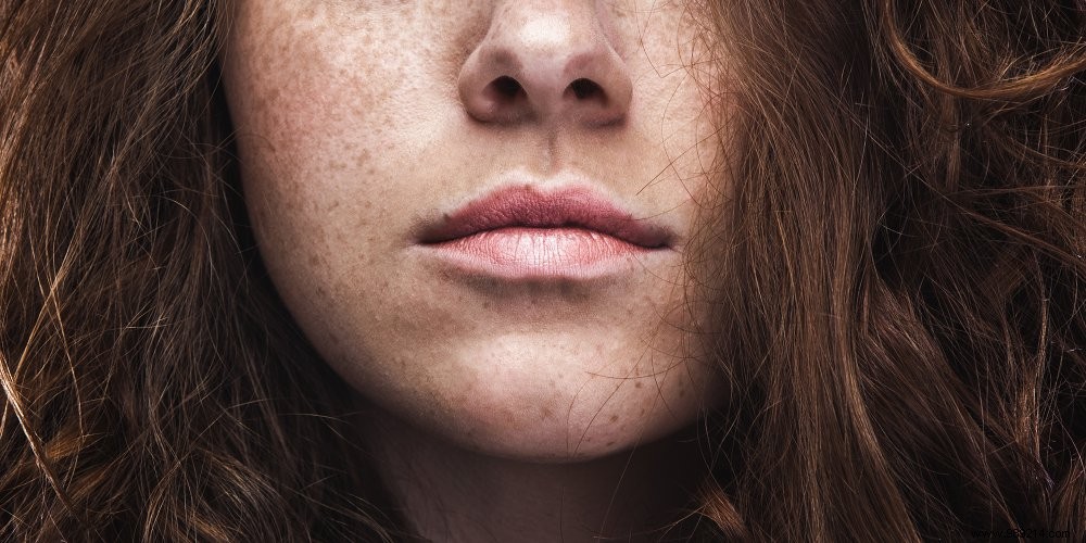 How to highlight freckles? 