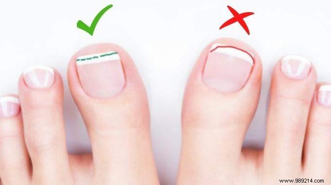The Tip For Cutting Your Toenails (And Avoiding Ingrown Toenails). 