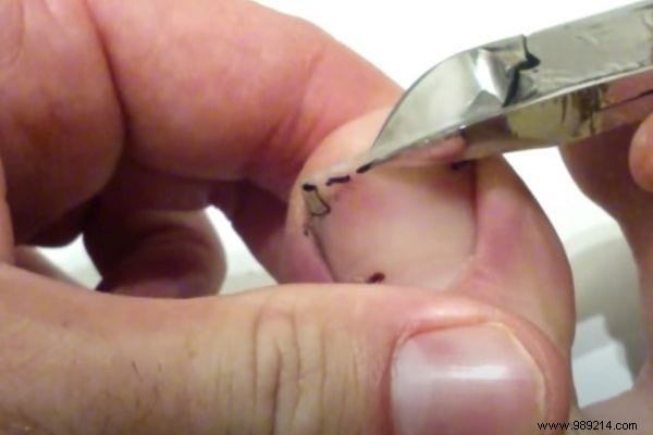 The Tip For Cutting Your Toenails (And Avoiding Ingrown Toenails). 