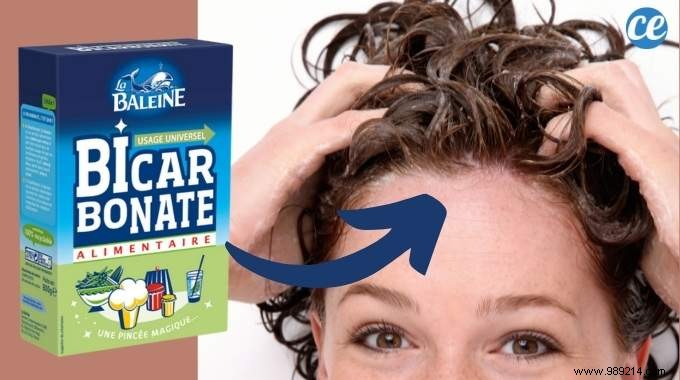 Baking Soda For Hair:5 Benefits Nobody Knows About. 