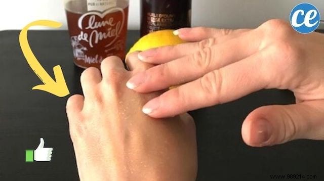 Chapped Hands? Grandma s Remedy Your Skin Will Love! 