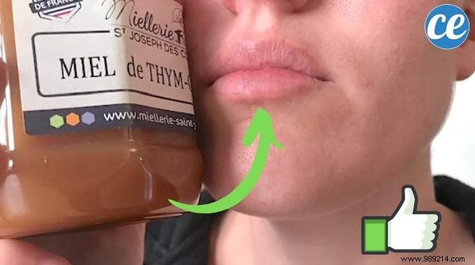 How to Cure Chapped Lips? Here is The Quick And Effective Remedy. 