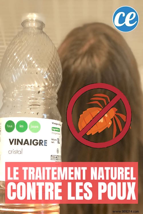 White Vinegar:The Dreadful Remedy That All Lice Hate! 