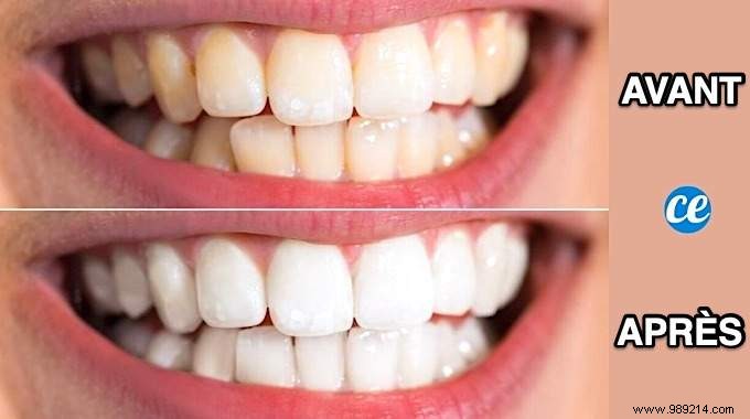 Whiten Your Teeth Fast With This 100% Natural Tip. 