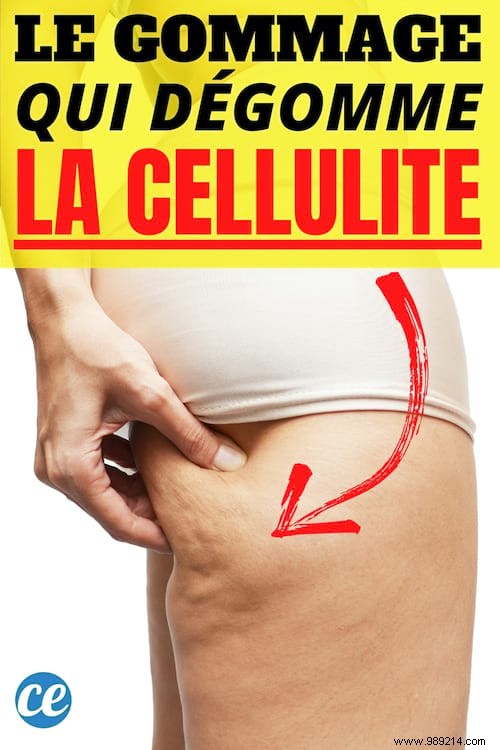 My Grandmother s Cellulite Recipe That Really Works. 
