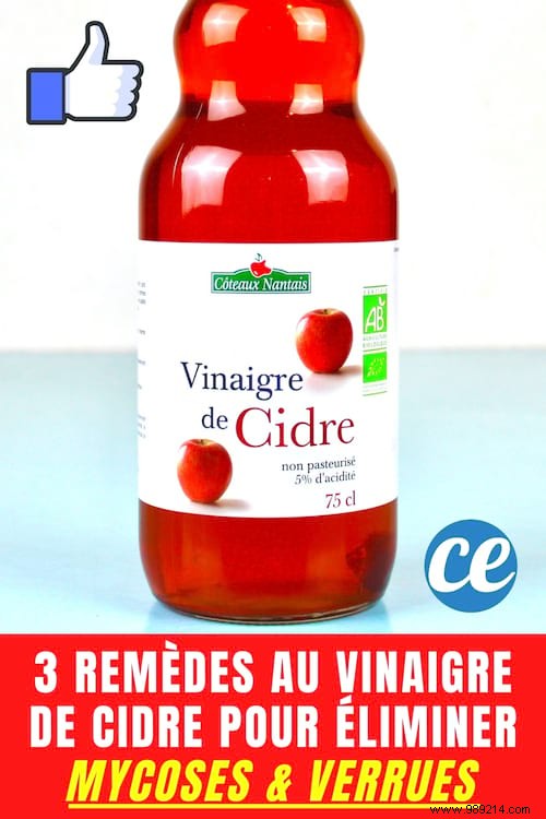 3 Apple Cider Vinegar Remedies To Eliminate Mycosis and Warts. 