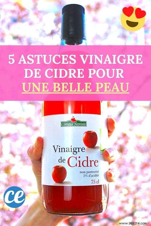 5 Apple Cider Vinegar Tips To Get Beautiful Skin Quickly. 