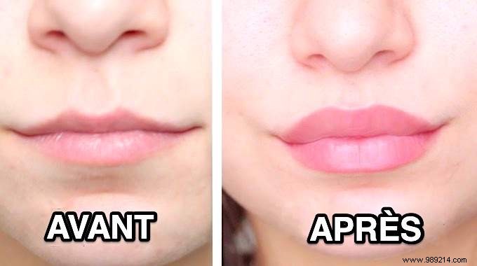 How To Get Fuller Lips Naturally? 12 Tricks That Work. 