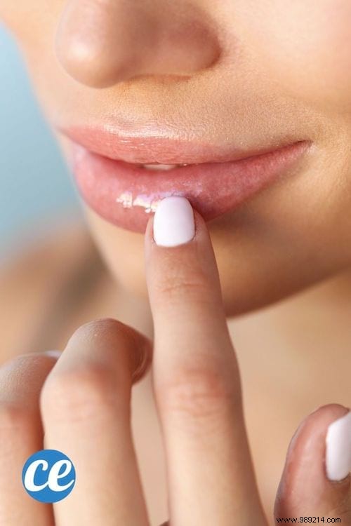 How To Get Fuller Lips Naturally? 12 Tricks That Work. 