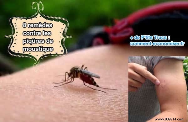 8 Home Remedies For Itchy Mosquito Bites. 