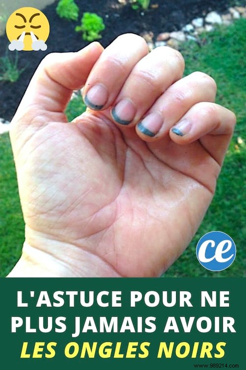 Gardening:THE Genius Trick to Never Have BLACK NAILS Again. 