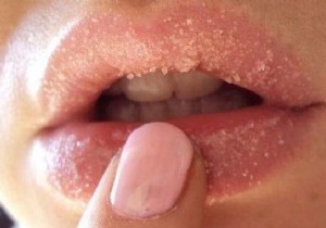 Do You Have Dry Lips? Discover My 2 Tips To Fix It. 