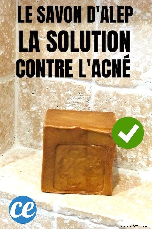 Solve All Your Acne Problems Quickly With Aleppo Soap. 