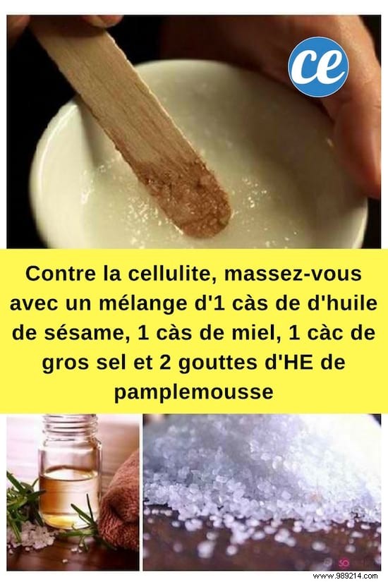 My Natural and Economic Anti-Cellulite Treatment to Do It Yourself. 