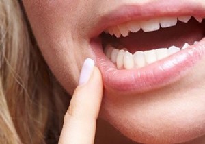Fast Mouth Ulcer Relief: Proven Salt Water Rinse Remedy