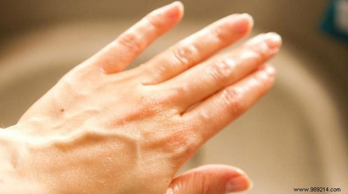 The Amazing Trick to Soften Your Hands Naturally in 2 Min. 