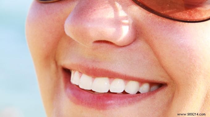 3 Tips For Natural Teeth Whitening That Restores Smile. 
