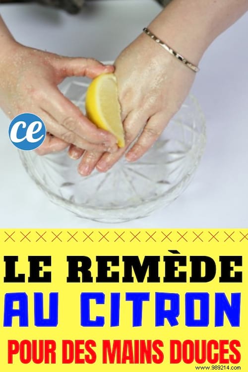 Silky Soft Hands with My Lemon Remedy. 
