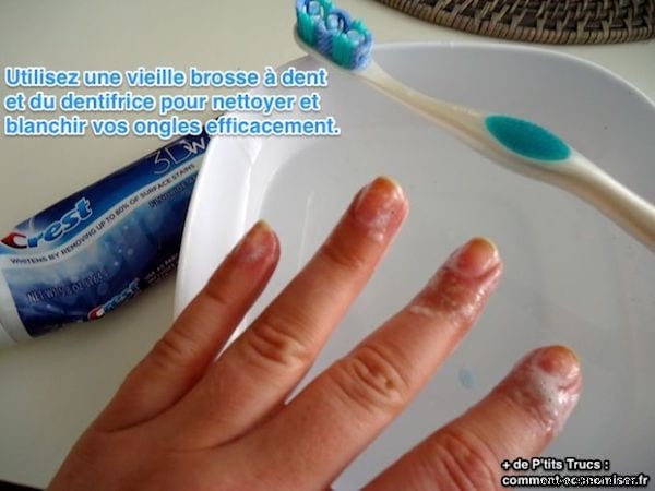 The Awesome Tip To Whiten Your Nails In Less Than 1 Minute. 