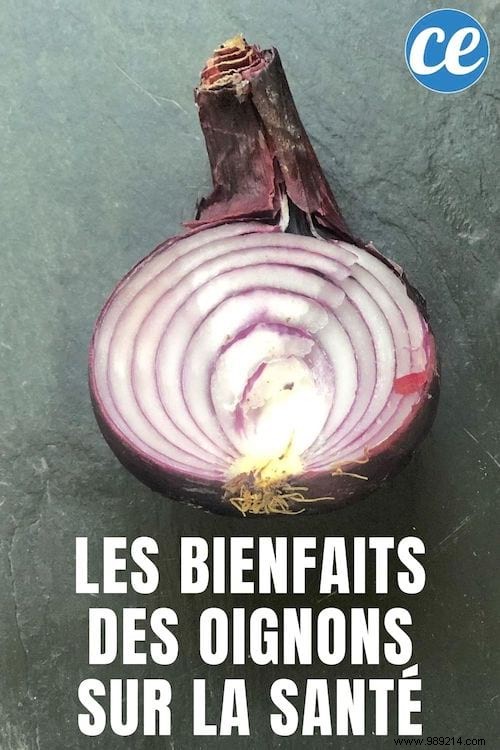 The Health Benefits of Onions. 