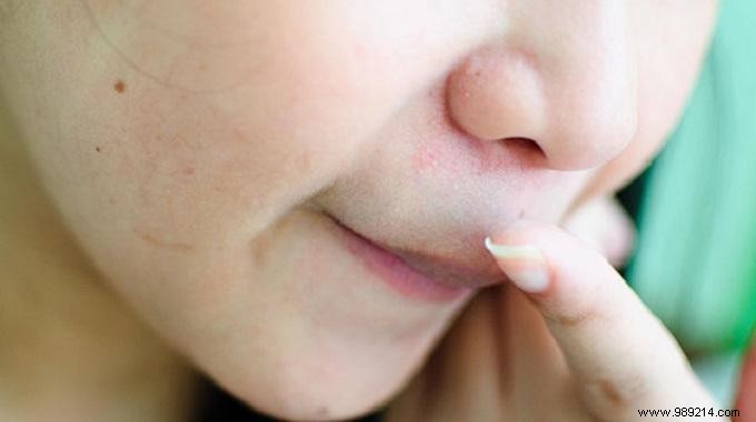 The Effective Trick To Relieve An Irritated Nose. 