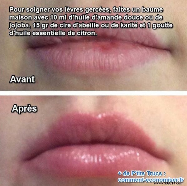 Grandma s Infallible Remedy for Chapped Lips. 