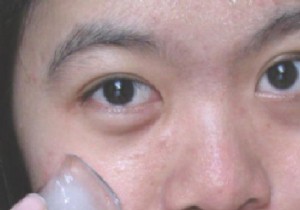 The Miracle Remedy for Bags Under the Eyes. 