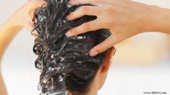 11 Natural Remedies To Get Rid Of Dandruff. 