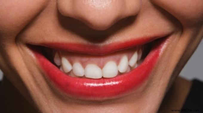 The Ideal Recipe To Whiten Your Teeth Effectively and Naturally. 