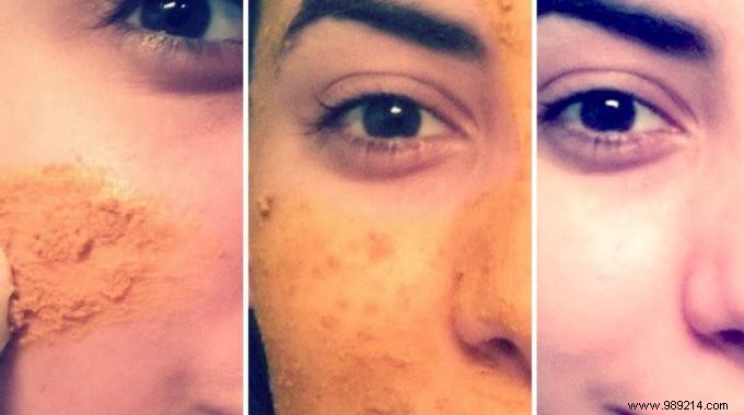 Discover the Turmeric Mask That Fights Wrinkles. 