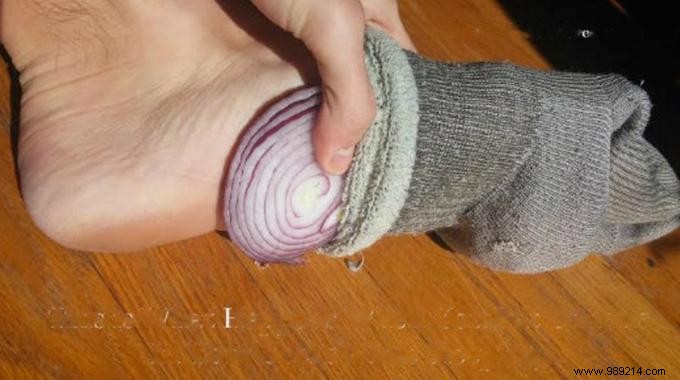 Here s What Happens When You Put Onions In Your Socks Overnight. 