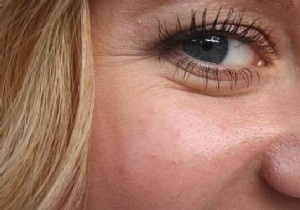 Get rid of your Blackheads with my Homemade Patches! 