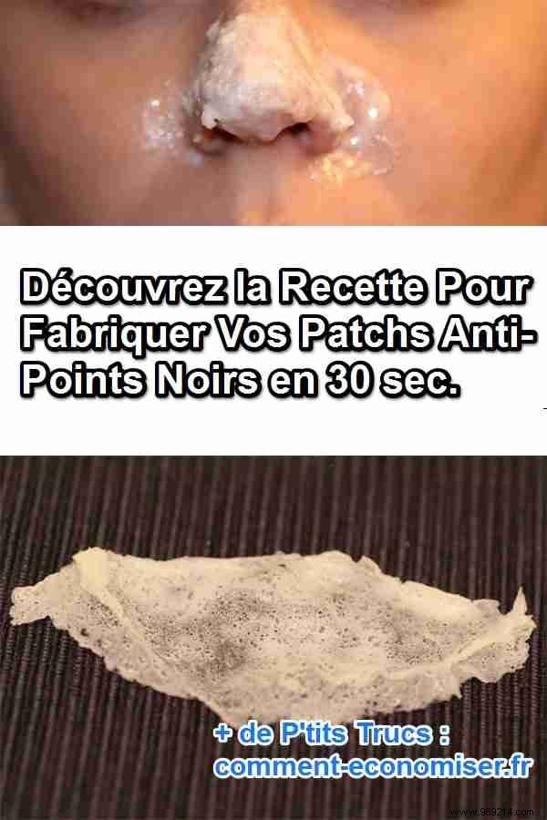 Make Your Anti-Blackhead Patches in 30 seconds. 