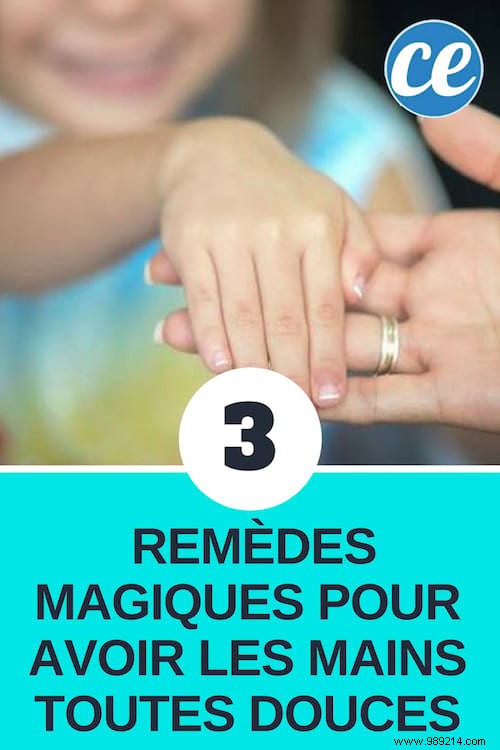 3 Magical Remedies For Soft Hands. 