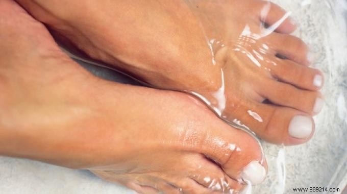 Excessive Foot Sweating? My Effective Solution. 