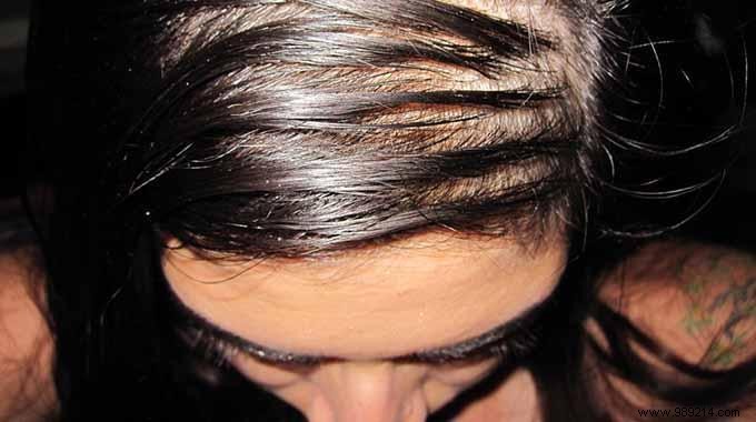 The 3 tips that work to stop having oily hair. 