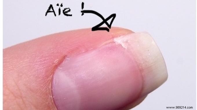 Tutorial:How to Repair a Broken Nail EASILY. 