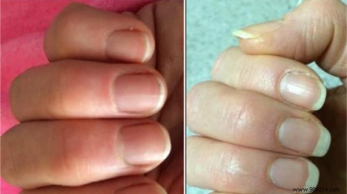 Grandma s Remedy To Make Your Nails Grow Faster. 
