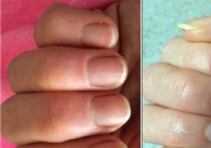 Grandma s Remedy To Make Your Nails Grow Faster. 