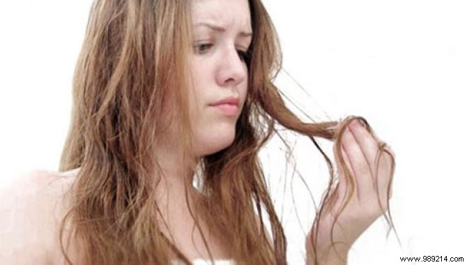 Dry hair and abysses ? 6 Simple Remedies That Have Been Proven. 