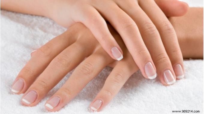5 Natural and Infallible Methods to Stop Biting Your Nails. 