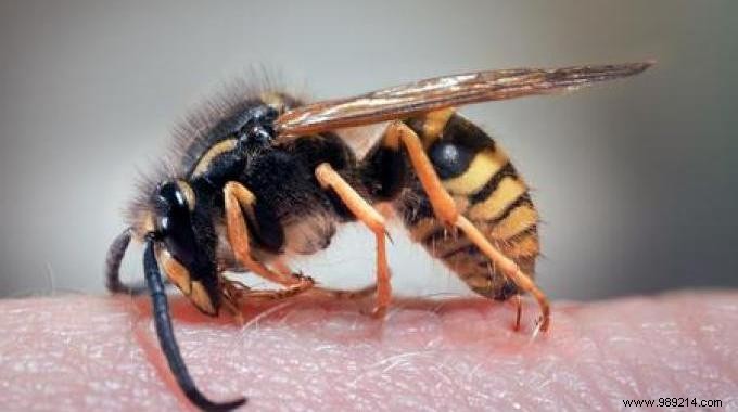 How to treat a wasp sting ? Our Effective Remedy. 