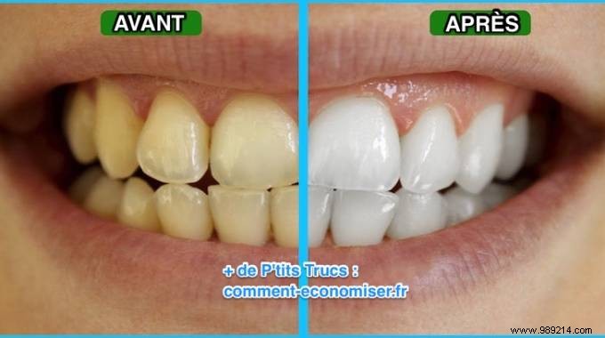 An Amazing Tip To Get White Teeth Naturally. 
