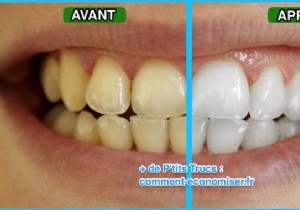 Natural Teeth Whitening at Home: Proven Lemon Juice Method for a Brighter Smile