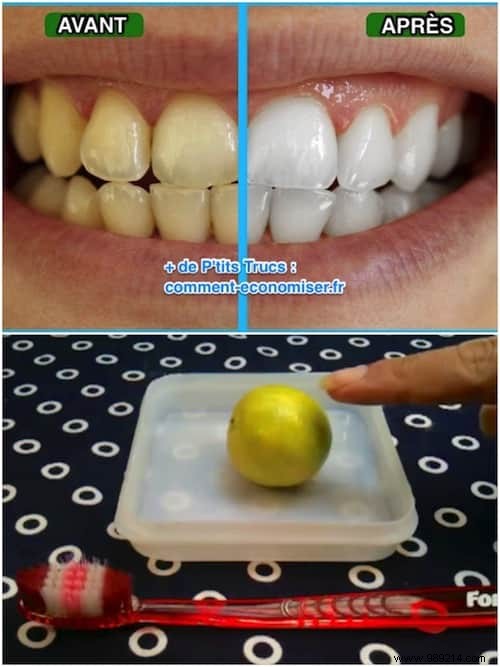An Amazing Tip To Get White Teeth Naturally. 