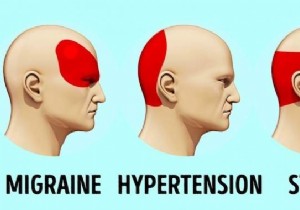 How to Get Rid of a Headache in 5 Min and WITHOUT Medication. 