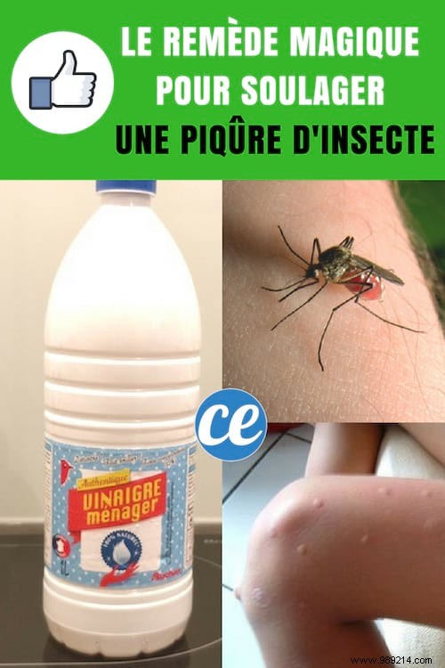 Insect Bites:How to Stop Itching With White Vinegar. 