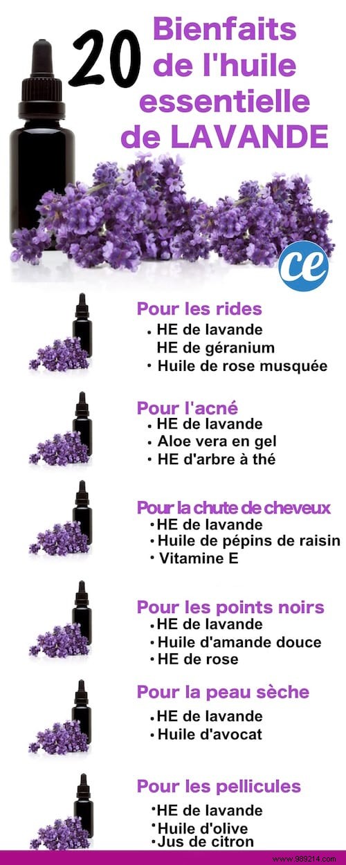 21 Lavender Essential Oil Uses Everyone Should Know. 