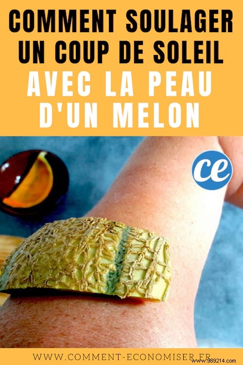 How to Relieve Sunburn With Melon Skin (And Avoid Blisters). 