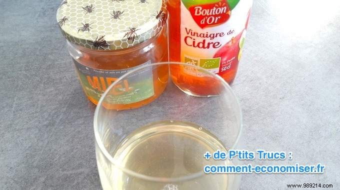 Honey + Apple Cider Vinegar:The Best Constipation Remedy. 